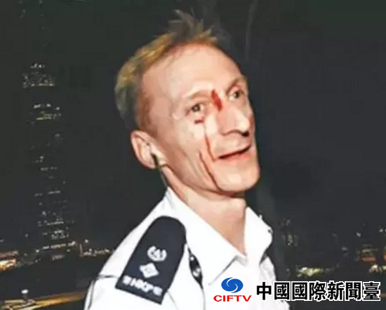 庄定贤2014年处理反对派煽动的非法“占中”过程中,曾遭暴徒袭击导致血流满面。(资料图)