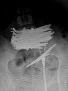 Ů�����������½�10�Ѽ���(ͼ)